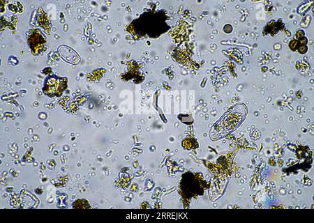 Bodenmikroorganismen aus der Nähe unter dem Mikroskop. In einem Boden aus einem Bauernhof Stockfoto