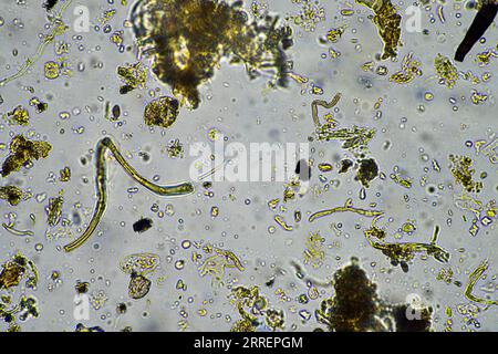Bodenmikroorganismen aus der Nähe unter dem Mikroskop. In einem Boden aus einem Bauernhof Stockfoto