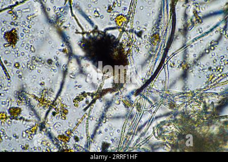 Bodenmikroorganismen aus der Nähe unter dem Mikroskop. In einem Boden aus einem Bauernhof Stockfoto