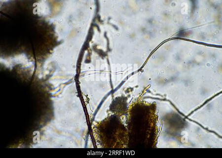 Bodenmikroorganismen aus der Nähe unter dem Mikroskop. In einem Boden aus einem Bauernhof Stockfoto