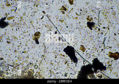 Bodenmikroorganismen aus der Nähe unter dem Mikroskop. In einem Boden aus einem Bauernhof Stockfoto