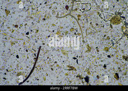 Bodenmikroorganismen aus der Nähe unter dem Mikroskop. In einem Boden aus einem Bauernhof Stockfoto