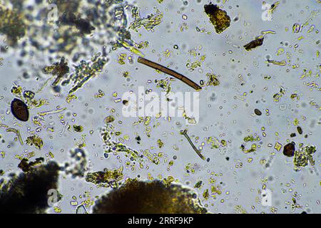Bodenmikroorganismen aus der Nähe unter dem Mikroskop. In einem Boden aus einem Bauernhof Stockfoto