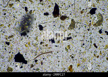 Bodenmikroorganismen aus der Nähe unter dem Mikroskop. In einem Boden aus einem Bauernhof Stockfoto