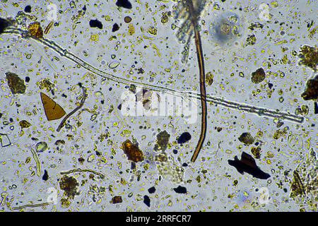 Bodenmikroorganismen aus der Nähe unter dem Mikroskop. In einem Boden aus einem Bauernhof Stockfoto