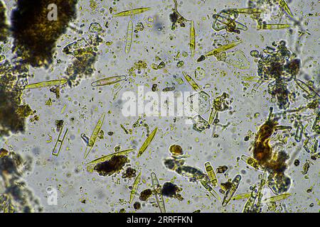 Bodenmikroorganismen aus der Nähe unter dem Mikroskop. In einem Boden aus einem Bauernhof Stockfoto