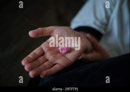 Berlin, Deutschland. 26. August 2023. Ein Kind hält einen Kaugummi in der Hand. Annette Riedl/dpa/Alamy Live News Stockfoto