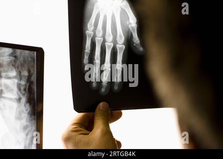 Hand des medizinisches Fachpersonal Röntgenaufnahme einer Hand halten Stockfoto