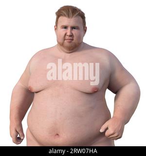 Übergewichtiger Mann, Illustration Stockfoto
