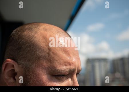 Schweiß brach auf der Stirn eines übergewichtigen Mannes aus, der bei heißem Wetter in der Sonne stand. Stockfoto