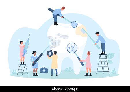 Kariesbehandlung, Zahnarztvektorillustration. Karikatur kleine Zahnärzte behandeln großen Zahn auf medizinische Untersuchung, Menschen kümmern sich um Zahnschmelz mit Plaque und Kavität mit Zahnbürste, sauber mit Zahnwerkzeug Stock Vektor