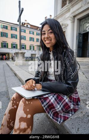 Eine junge lächelnde Schülerin mit Vitiligo, die mit ihrem Laptop sitzt. Hispanisches Mädchen Stockfoto