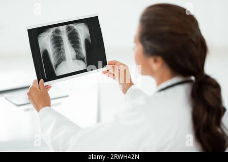 Arzthelferhände, die den Thoraxröntgenfilm des Patienten halten Stockfoto