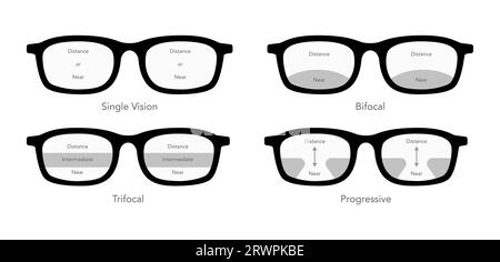 Set von Zonen des Sehens in Gleitsichtlinsen Blickfelder Augenrahmen Brillendiagramm Modeaccessoire medizinische Illustration. Sonnenbrille im Vorderansicht-Stil, Brille mit flachem Rand und Objektivskizze Stock Vektor