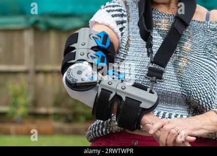 Ältere Frau mit Ossur Rebound Post-OP-Ellenbogenstütze, nachdem sie ihren Ellenbogen gebrochen und operiert wurde. Er ermöglicht die Einstellung für eingeschränkte Bewegung. Stockfoto