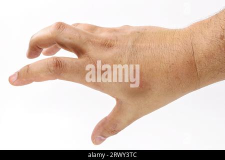 Männliche Hand, trocken und mit Hautflecken, dermatologisches Problem, Beginn der Sonnenmelanose, Haut ohne Sonnenschutzmittel, isoliert auf weißem Hintergrund, Stockfoto