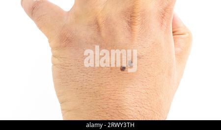 Männliche Hand, trocken und mit Hautflecken, dermatologisches Problem, Beginn der Sonnenmelanose, Haut ohne Sonnenschutzmittel, isoliert auf weißem Hintergrund, Stockfoto