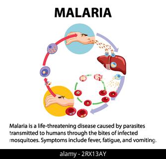 Illustrierte Infografik zur Darstellung der Stadien der Malaria-Parasitenübertragung Stock Vektor