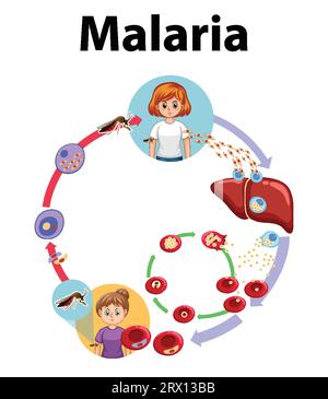 Illustrierte Infografik zur Darstellung der Stadien der Malaria-Parasitenübertragung Stock Vektor