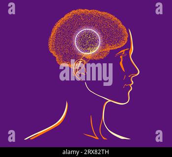 Schmerzen im Kopf, Gehirn und Synapsen, kognitive Probleme, geistige Defizite. Aneurysma. Degenerative Erkrankungen des Hirnareals. Parkinson Stockfoto