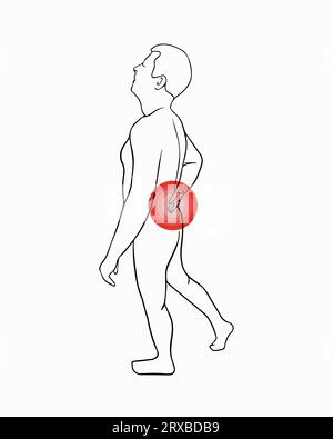 Vektorisolierte Darstellung von Rückenschmerzen. Umrisszeichnung eines Mannes, der seinen Rücken hält. Schmerzkonzentration im unteren Rücken. Stock Vektor