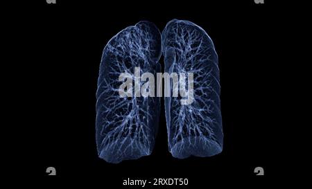 CT-Thorax- oder CT-Lungen-3D-Rendering-Bild mit blauer Farbe, das Trachea und Lunge im Atemsystem zeigt. Stockfoto