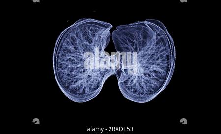 CT-Thorax- oder CT-Lungen-3D-Rendering-Bild mit blauer Farbe, das Trachea und Lunge im Atemsystem zeigt. Stockfoto