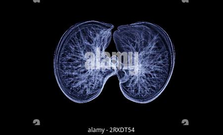 CT-Thorax- oder CT-Lungen-3D-Rendering-Bild mit blauer Farbe, das Trachea und Lunge im Atemsystem zeigt. Stockfoto