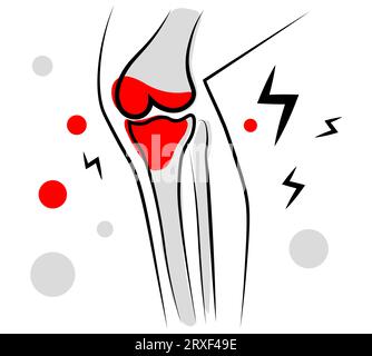 Knieschmerzen. Vektorillustration Stock Vektor