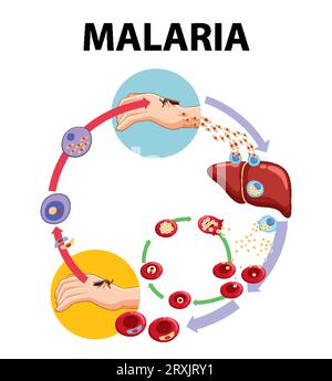 Illustrierte Infografik zur Darstellung der Stadien der Malaria-Parasitenübertragung Stock Vektor