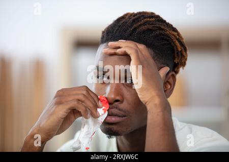 Junger Mann hat Nasenbluten Stockfoto