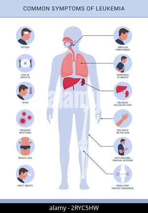 Häufige Symptome und Anzeichen von Leukämie, Infografik mit Symbolen Stock Vektor