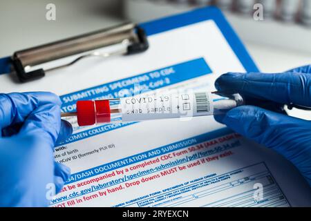 RT-PCR COVID-19-Virusdiagnostik Stockfoto