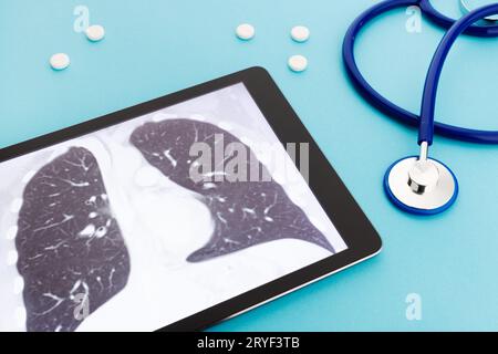 Tablet-Computer mit Lunge-Röntgen und Stethoskop und Pillen auf blauem Hintergrund. Konzept für Lungenerkrankungen Stockfoto