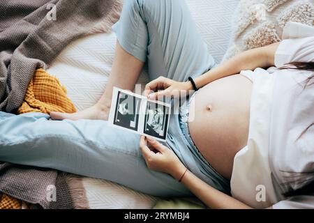 Unerkennbare schwangere Frau im dritten Trimenon, die auf dem Bett liegt und sich einen medizinischen Ultraschall anschaut. Das Konzept eines gesunden Glücks Stockfoto