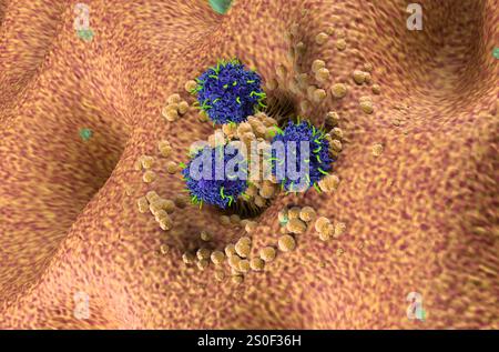 CAR-T-Zell-Therapie beim Magenkarzinom (Magen) - isometrische Darstellung 3D-Illustration Stockfoto