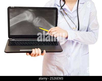 Krankenschwester Punkte auf Computer Laptop mit Röntgenbild des menschlichen Kniegelenks auf Bildschirm isoliert auf weißem Hintergrund Stockfoto