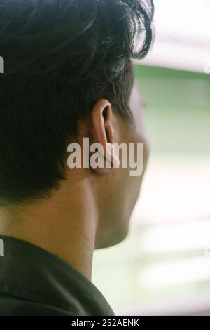 Ein auffälliger Klumpen, der an zusätzliches Fleisch erinnert, befindet sich oberhalb des Halses in der Nähe des Ohres, was einen einzigartigen körperlichen Zustand hervorhebt Stockfoto