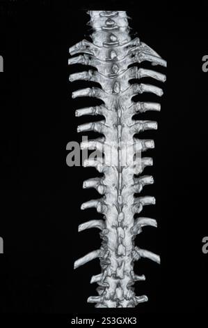 Spinale mrt-Bilder Stockfoto