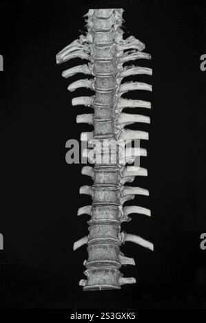 Spinale mrt-Bilder Stockfoto