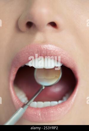 Nahaufnahme eines Weibes Mund während zahnärztliche Untersuchung Stockfoto