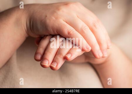 Frau zeigt ihre Hände mit gebissenen Nägeln. Kleine Nagelplatte. Schlechte Maniküre Stockfoto