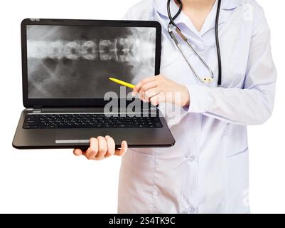 Krankenschwester Punkte auf Computer Laptop mit Röntgenbild der menschlichen Wirbelsäule auf Bildschirm isoliert auf weißem Hintergrund Stockfoto