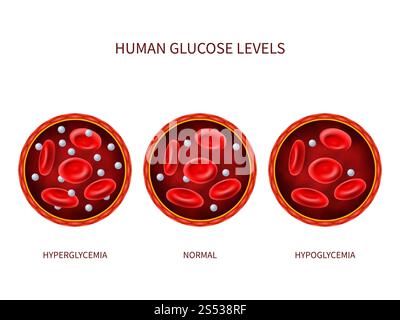 Glukosespiegel beim Menschen Hyperglykämie, normal, Hypoglykämie. Hämatologisches Vektordiagramm mit Blutgefäß, Erythrozyten und Zucker. Illustration der diabetischen Krankheit, Krankheitsdiagnostik. Glukosespiegel beim Menschen Hyperglykämie, normal, Hypoglykämie. Hämatologisches Vektordiagramm mit Blutgefäß, Erythrozyten und Zucker Stock Vektor
