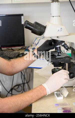 Der Bediener verwendet ein optisches Mikroskop, um Blutproben auf Objektträgern zu betrachten Stockfoto