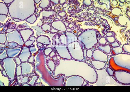 Schilddrüsenerkrankung 100x Stockfoto