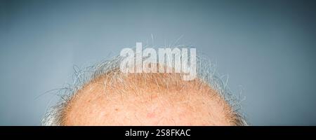 Nahaufnahme des Glatzenkopfes Stockfoto