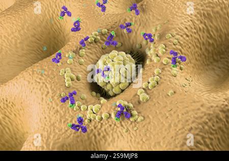 Monoklonale Antikörpertherapie beim Magenkarzinom (Magen) - isometrische Darstellung 3D-Illustration Stockfoto