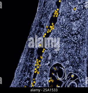 Transmissionselektronenmikroskop von West-Nil-Viruspartikeln (gelb), die sich im Zytoplasma einer infizierten VERO-E6-Zelle (blau) replizieren. Stockfoto