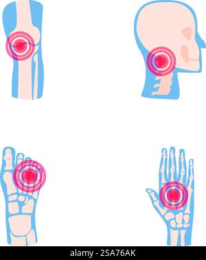 Symbole für Gelenkerkrankungen setzen Cartoon-Vektor. Menschliches Gelenk mit rotem Schmerzring. Rheumatologie, Medizin. Symbole für Gelenkerkrankungen setzen Cartoon-Vektor. Menschliches Gelenk mit rotem Schmerzring Stock Vektor